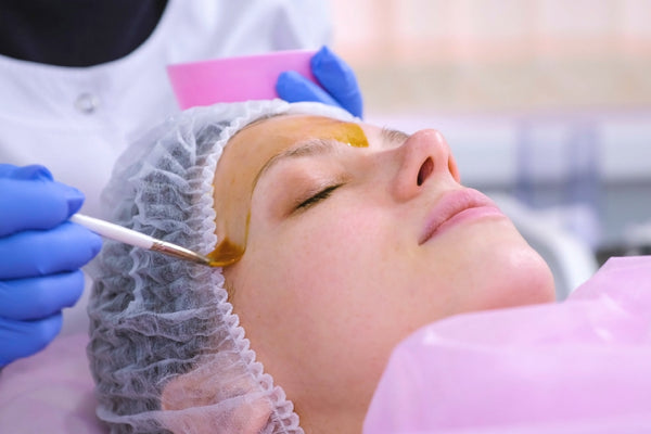Advanced Chemical Peel Class