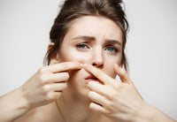 Acne Peels and LED with Home Care