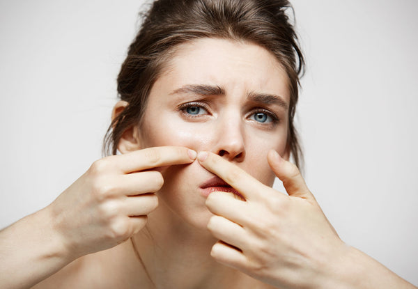 Acne Peels and LED with Home Care