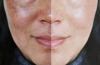INTENSIVE Class III (NOVEMBER) - Demanding Skin, Brightening & Melafadin