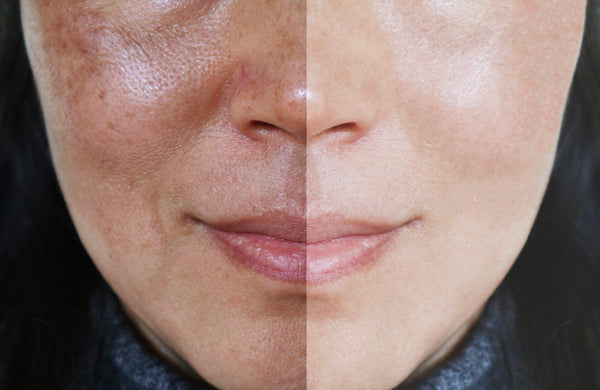 INTENSIVE Class III (NOVEMBER) - Demanding Skin, Brightening & Melafadin