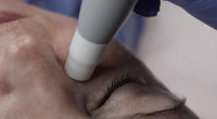 Janssen Facial  with  SKIN PERFECTOR  DEVICE