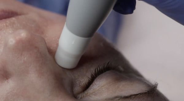 Janssen Facial  with  SKIN PERFECTOR  DEVICE